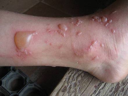 �������� ��������: ��������.